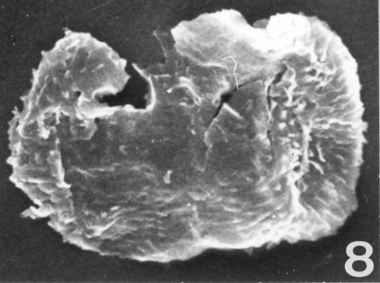 Fig. 8 - Acanthodiacrodium angustum (Downie, C., 1958) Combaz, A., 1967. CHE-31. I. R. Se. N. B. N° b534.