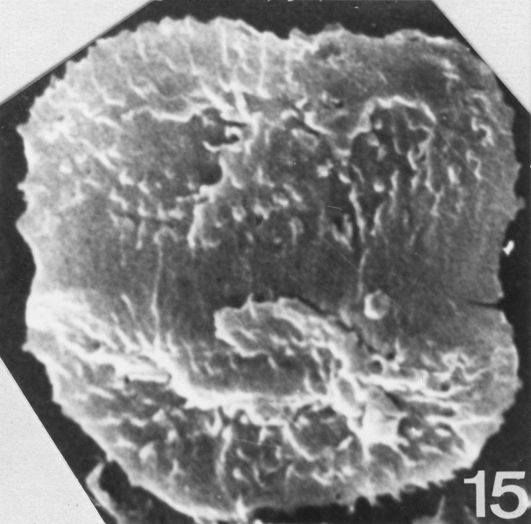 Fig. 15 - Acanthodiacrodium angustum (Downie, C., 1958) Combaz, A., 1967. CHE-31. I. R.Sc. N.B. N° b533.