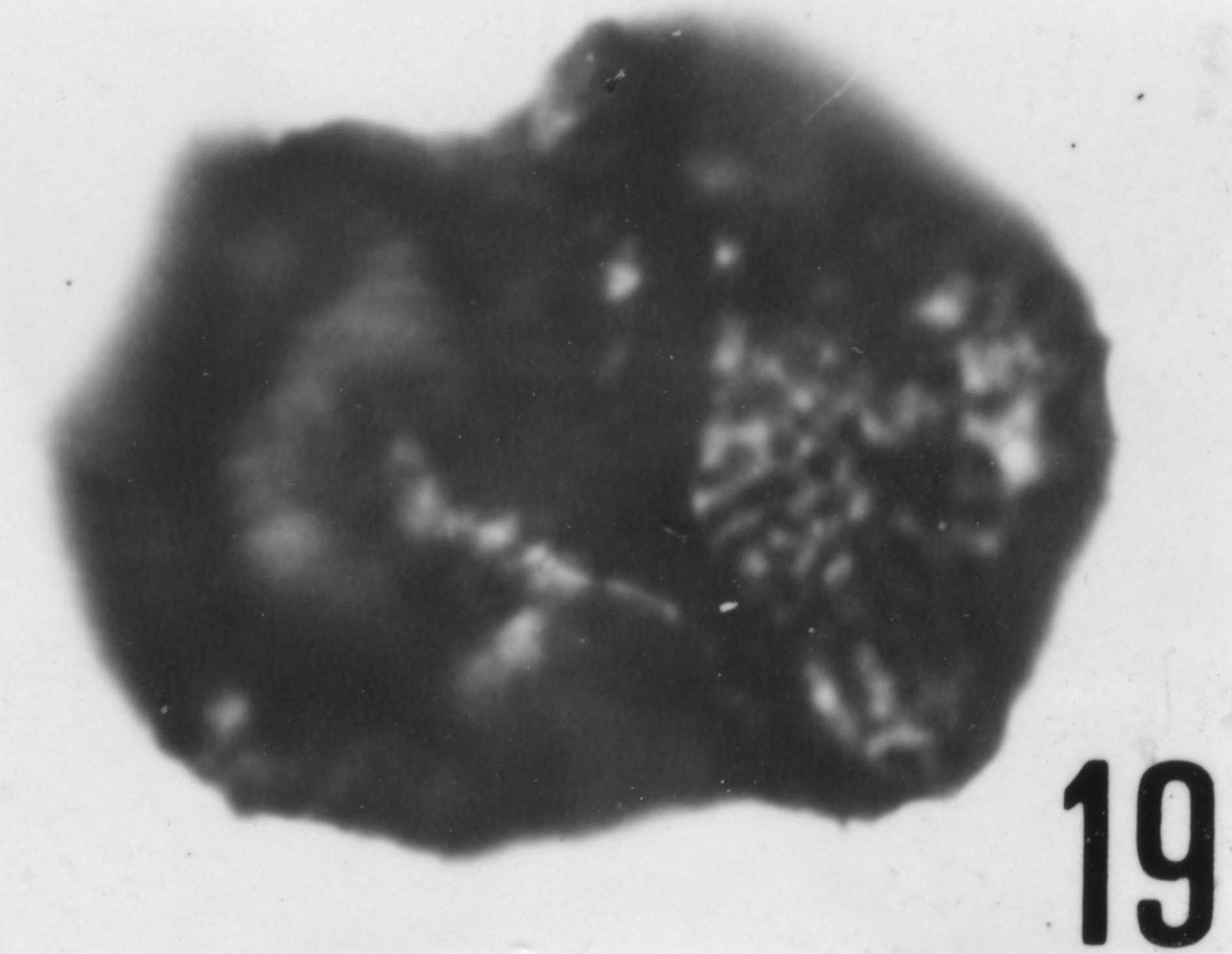 Fig. 19 - Acanthodiacrodium angustum (Downie, C., 1958) Combaz, A., 1967. CHE-21. I. R. Se. N. B. N° b497. 