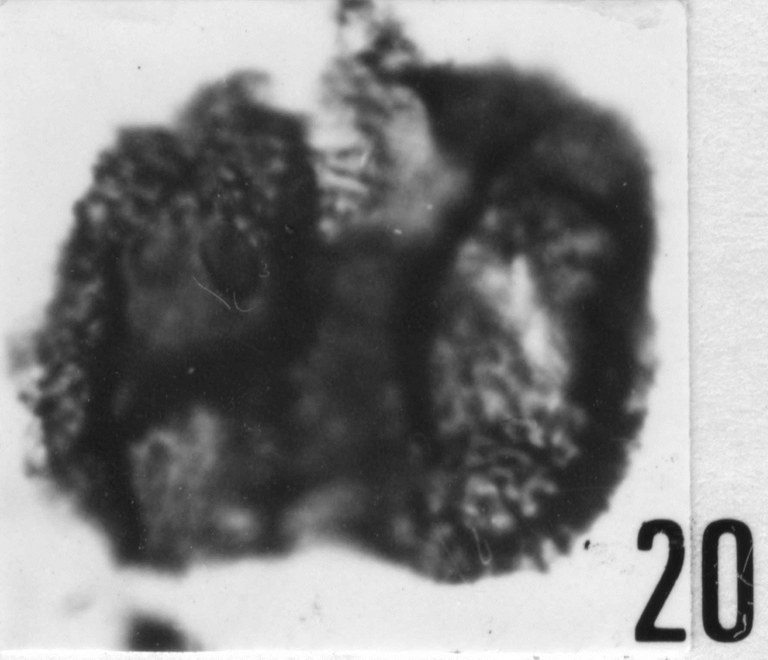 Fig. 20 - Acanthodiacrodium angustum (Downie, C., 1958) Combaz, A., 1967. CHE-25. I. R. Sc. N. B. N° b503.