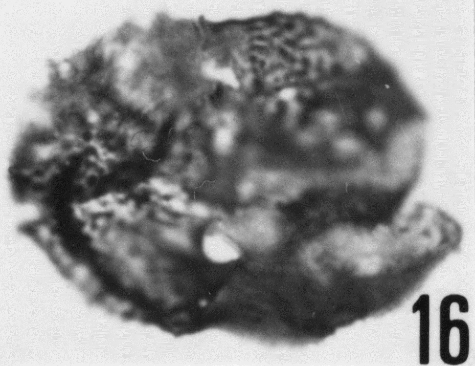 Fig. 16 - Acanthodiacrodium angustum (Downie, C., 1958) Combaz, A., 1967. Spécimen ouvert longitudinalement en deux moitiés symétriques. CHE-22. I. R. Se. N. B. No b499. 