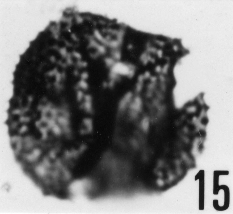 Fig. 15 - Acanthodiacrodium angustum (Downie, C., 1958) Combaz, A., 1967. CHE-32. I. R. Se. N. B. N° b512. 