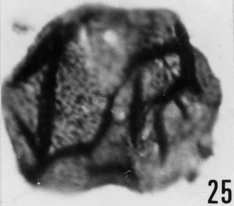 Fig. 25 - Acanthodiacrodium angustum (Downie, C., 1958) Combaz, A., 1967. CHE-32. I. R. Se. N. B. N° b512.
