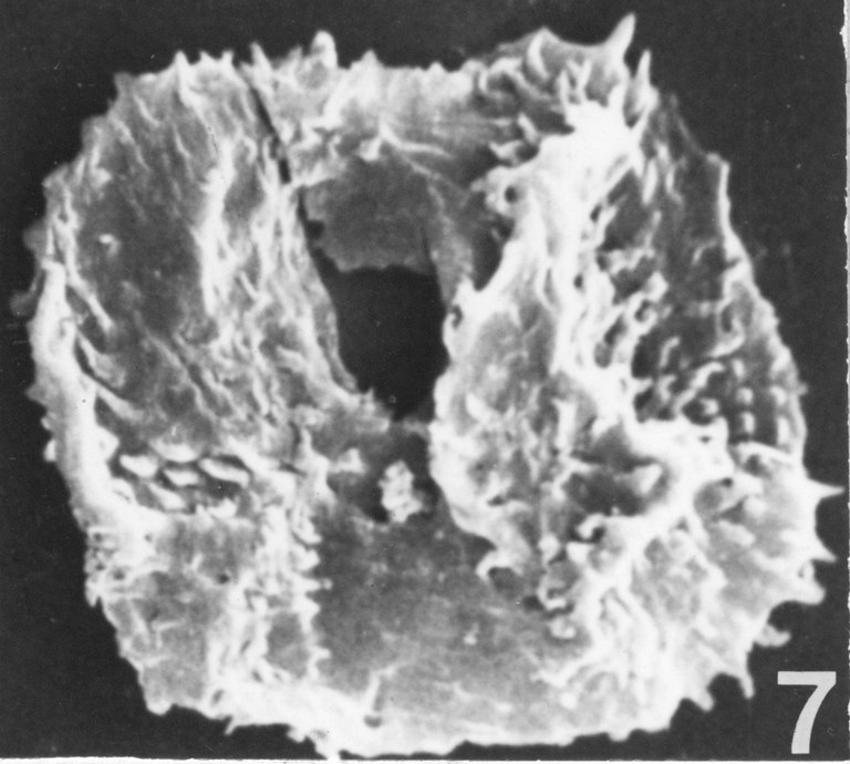 Fig. 7 - Acanthodiacrodium angustum (Downie, C., 1958) Combaz, A., 1967. CHE-31. I. R. Se. N.B. N° b530. 