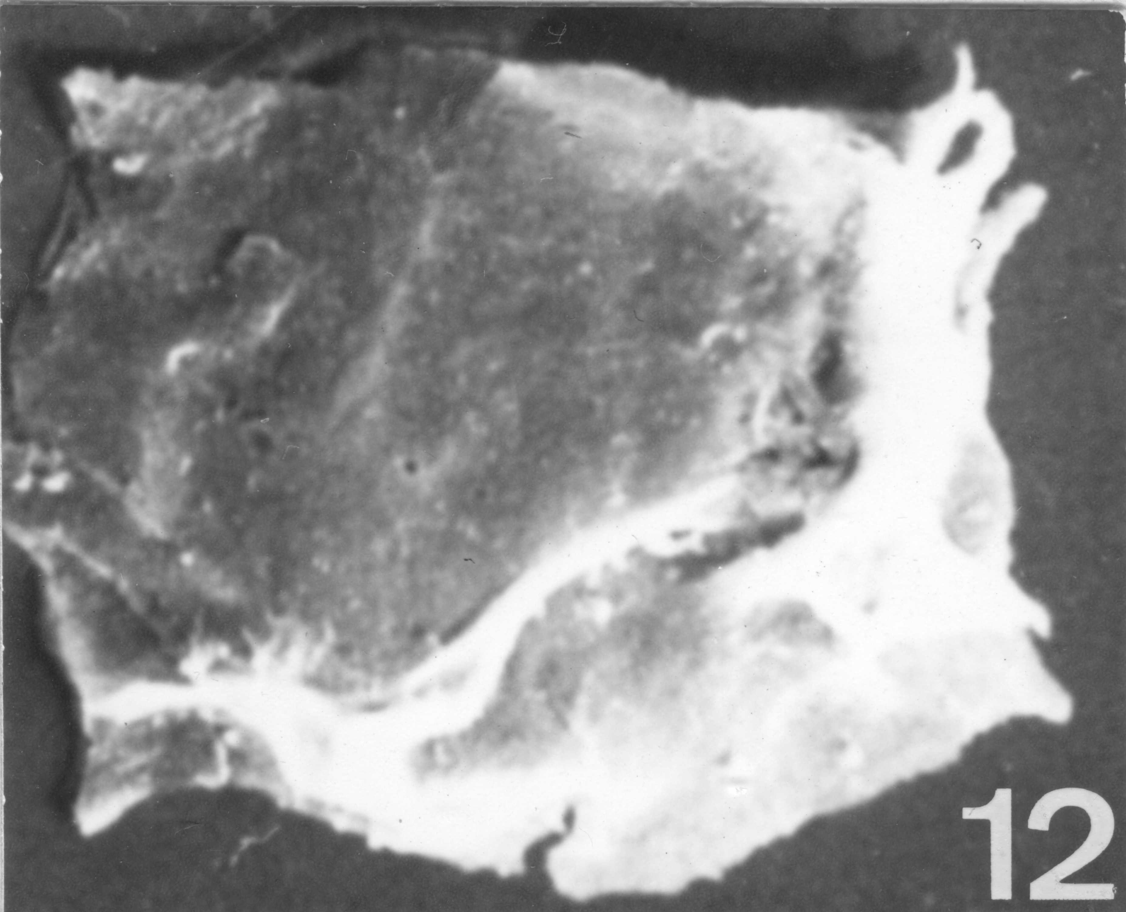 Fig. 12 - Acanthodiacrodium complanatum (Deunff, J., 1961) n. comb. CHE-18. I. R. Sc. N. B. N° b535. 