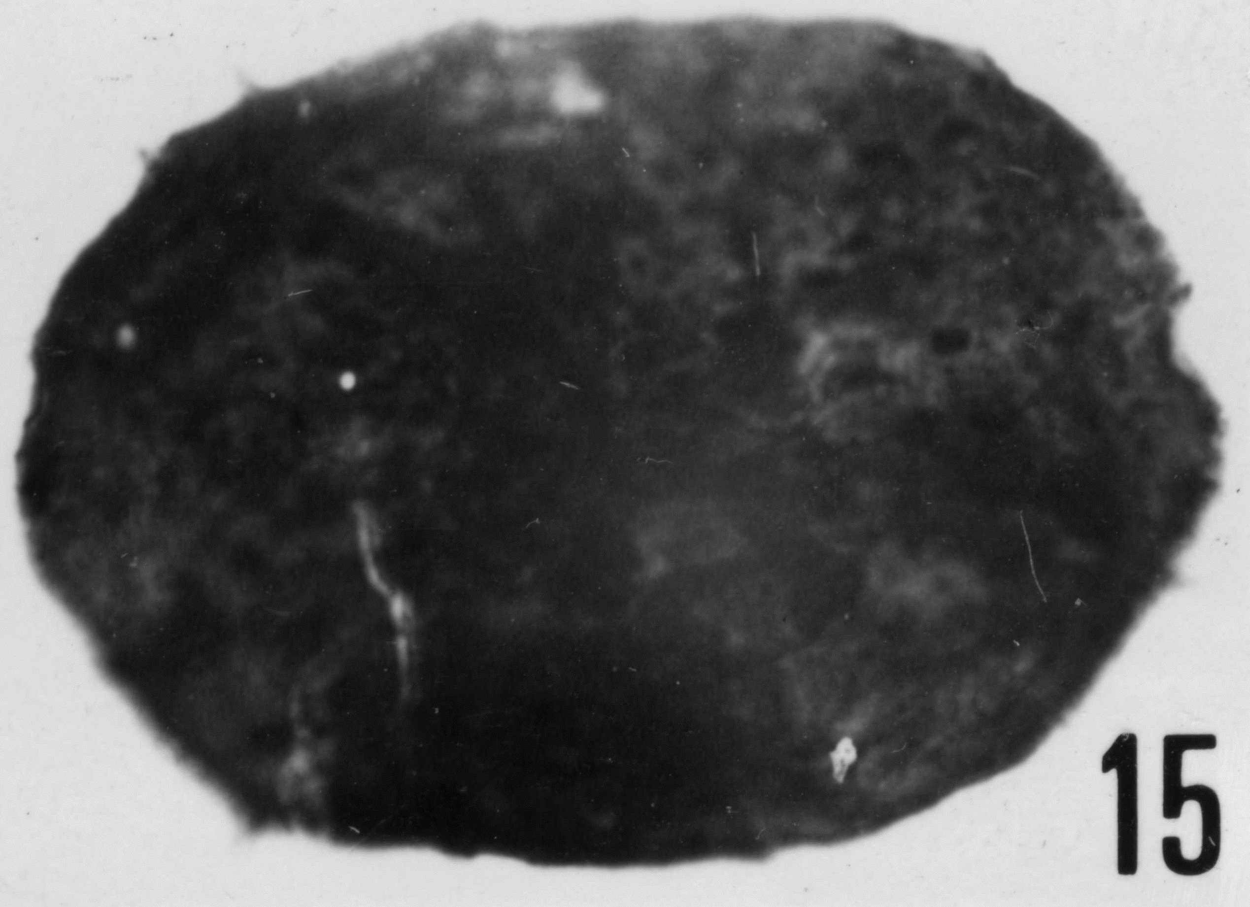 Fig. 15 - Acanthodiacrodium enodum Timofeev, B. V., 1959. THY-1. I. R. Se. N. B. No b488.