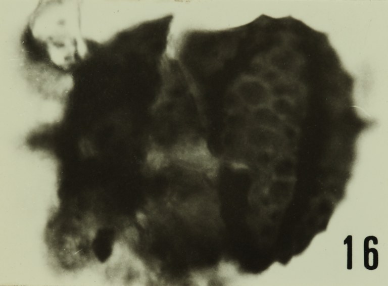 Fig. 16 - Acanthodiacrodium gr. I. Vanguestaine, M., 1967. La Roquemaillère : ROQ-4. b 441.