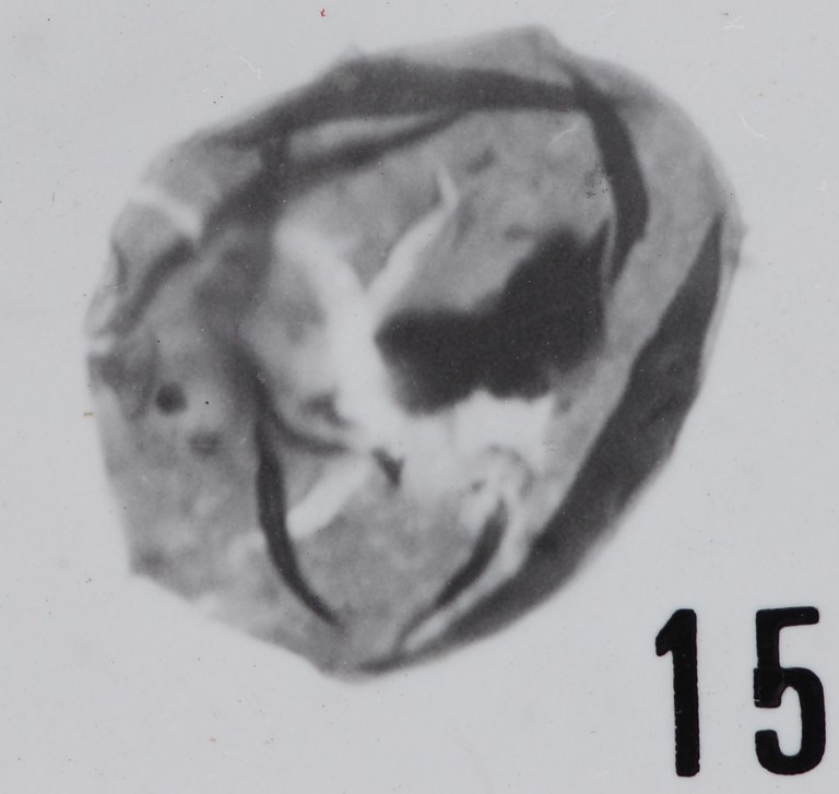 Fig. 15 - Acanthodiacrodium hamatum (Downie, C., 1958) n. comb. Roque de Bandies : RDB-1. b 428.