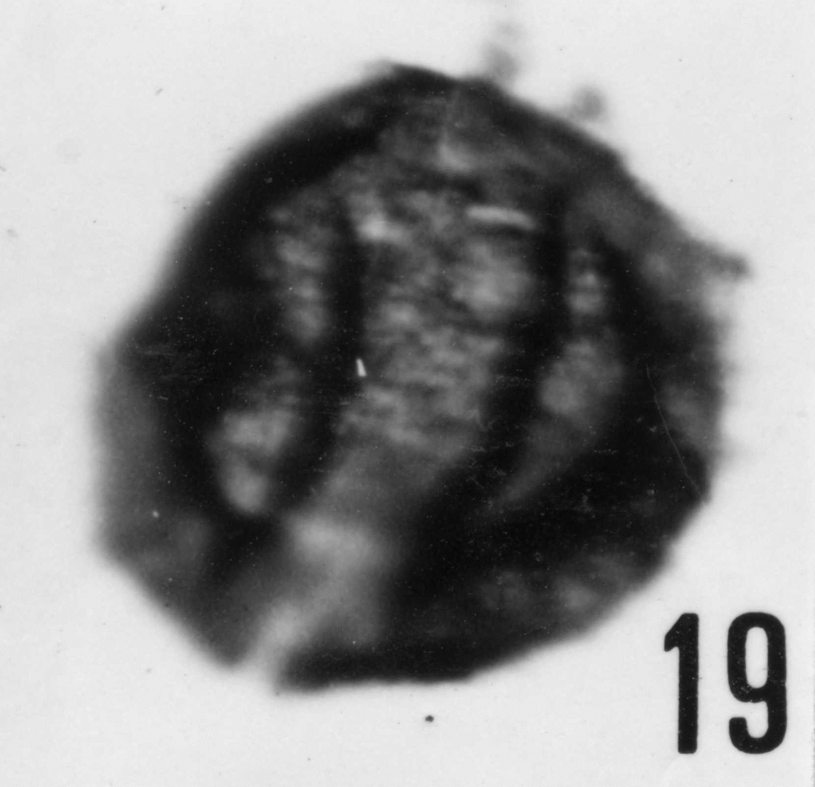 Fig. 19 - Acanthodiacrodium ? lanatum (Timofeev, B. V., 1959) Deflandre, G. et Deflandre-Rigaud, M., 1962. CHE-23. I. R. Sc. N. B. N° b500.