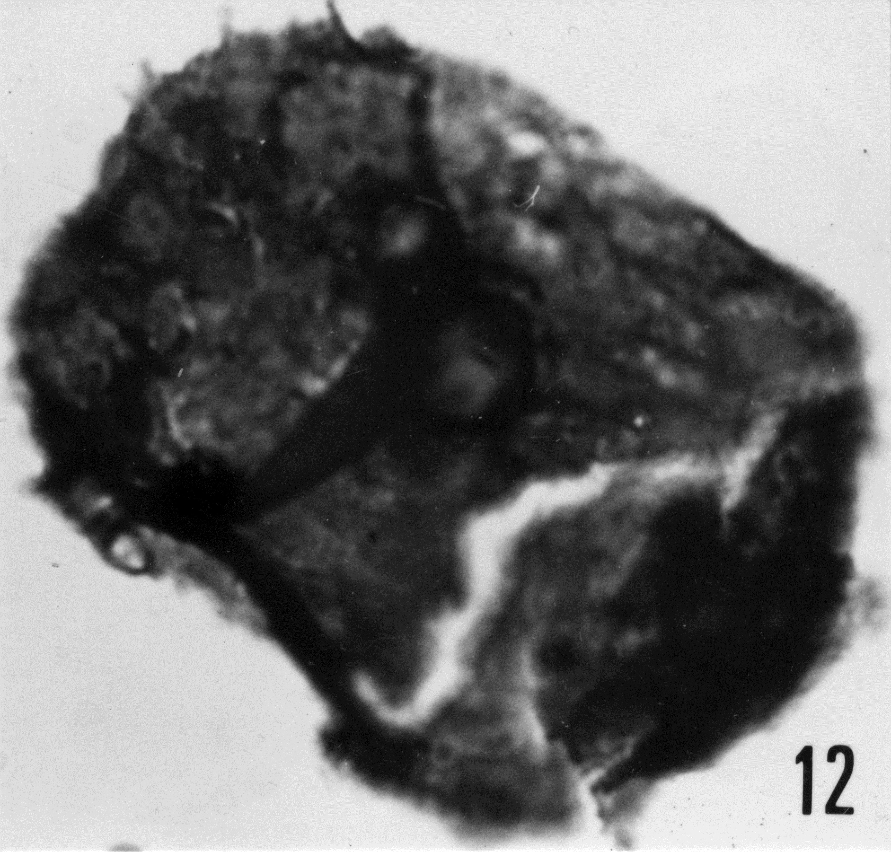 Fig. 12 - Acanthodiacrodium nidiuscidum (Timofeev, B. V., 1959) Deflandre, G. et Deflandre-Rigaud, M., 1962. THY-1. I. R. Se. N. B. N° b488. 