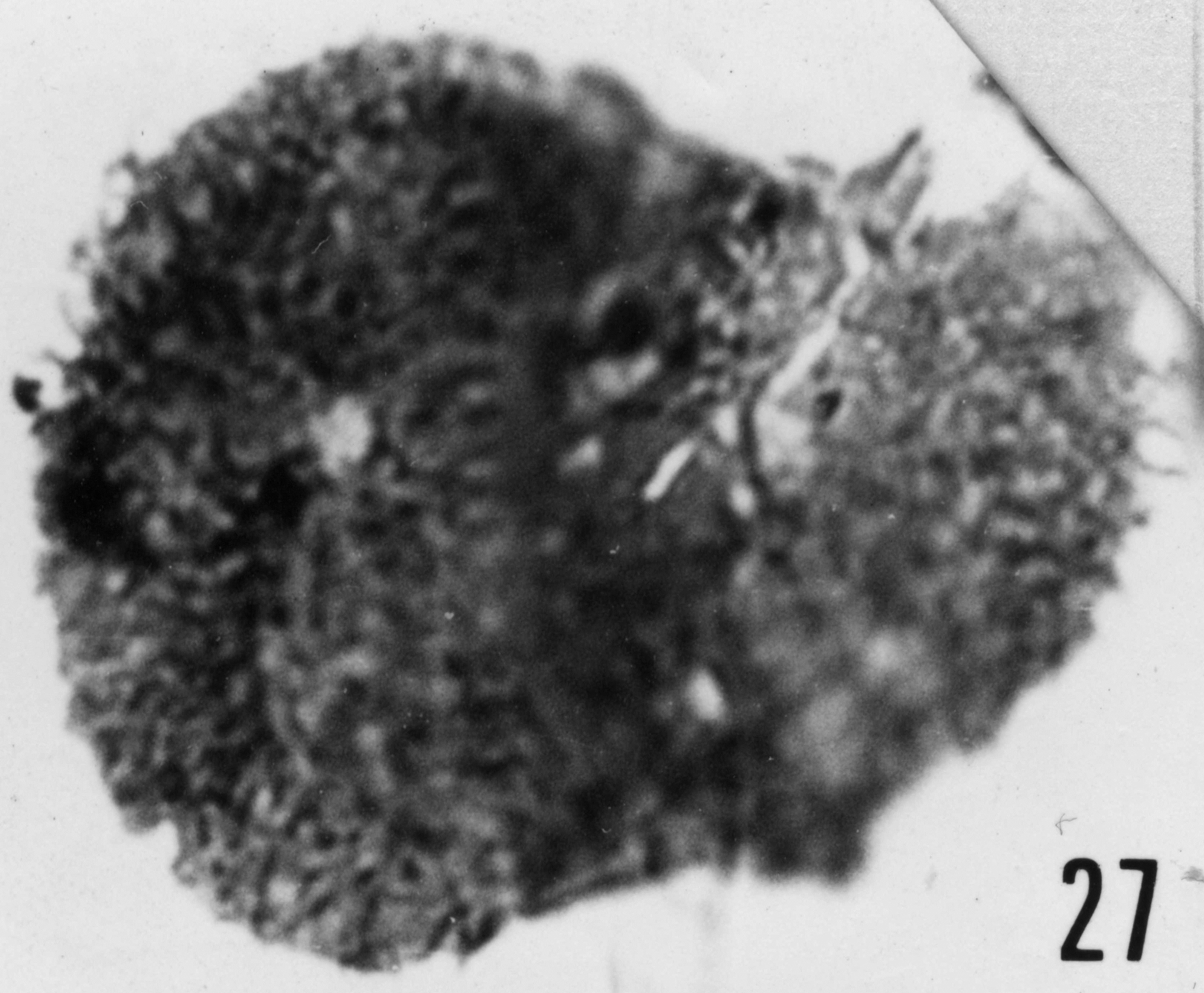 Fig. 27 - Acanthodiacrodium papillare Timofeev, B. V., 1959. THY-1. I. R. Se. N. B. N° b488.