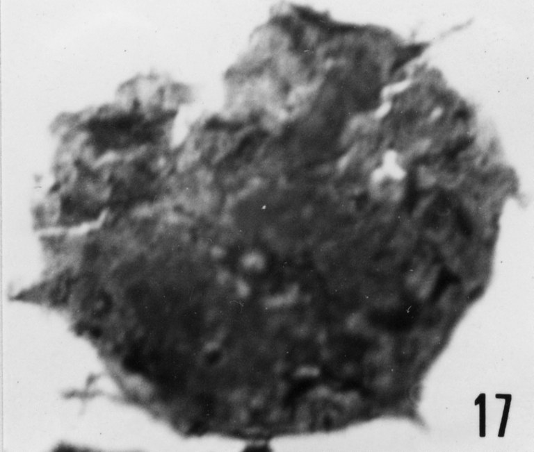 Fig. 17 - Acanthodiacrodium partiale Timofeev, B. V., 1959. THY-1. I. R. Se. N. B. No b488.