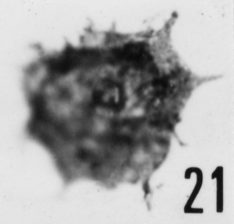 Fig. 21 - Acanthodiacrodium aff. A. scaberrimum (Timofeev, B. V., 1959) Deflan¬ dre, G. et Deflandre-Rigaud, M., 1959. THY-1. I. R. Ss. N. B. N° b488.