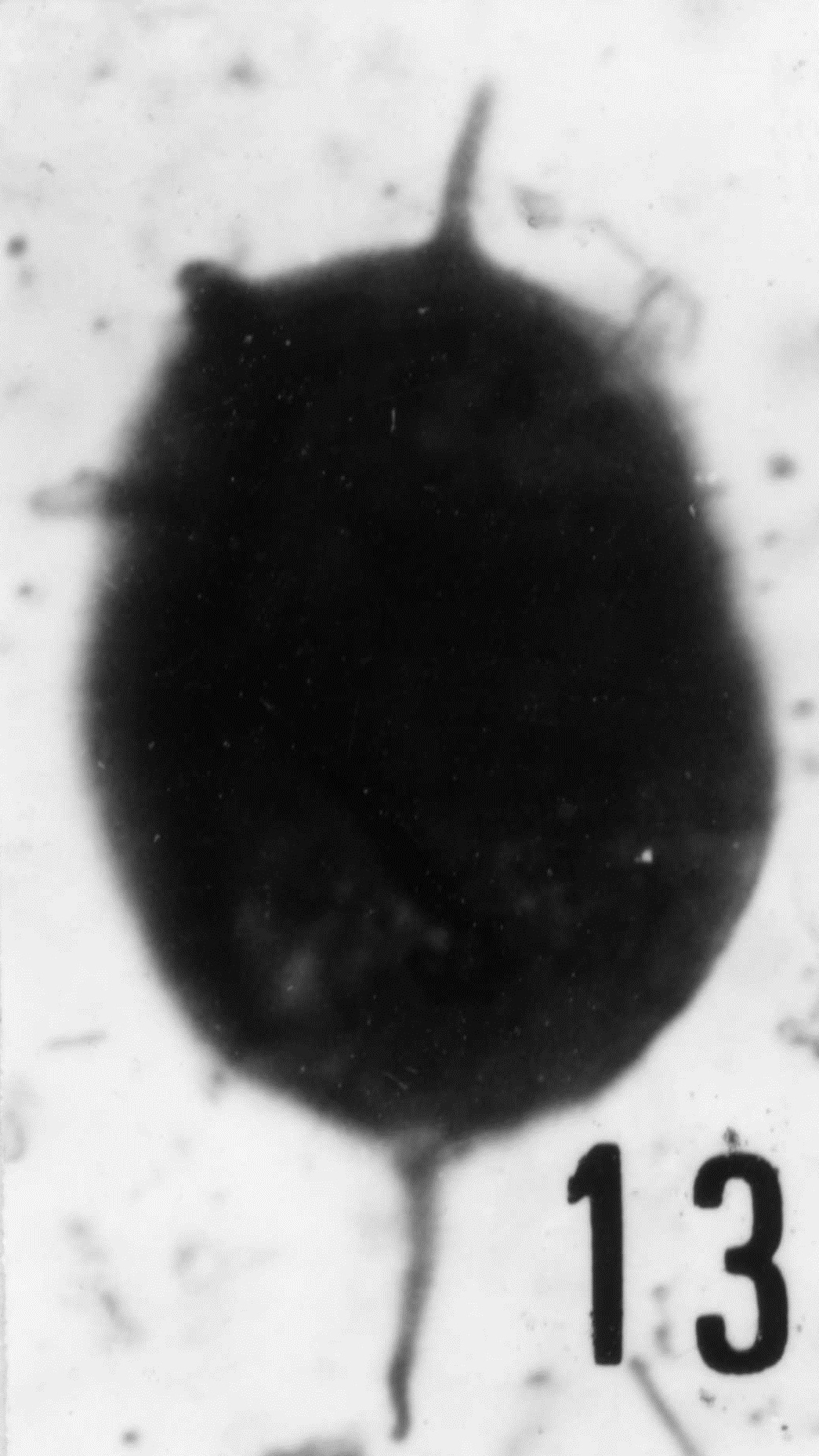 Fig. 13 - Acanthodiacrodium simplex Combaz, A., 1967. Lame mince. La Roque¬ maillère : ROQ-19. b 458.