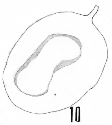 Fig. 10 - Acanthodiacrodium simplex Combaz, A., 1967. Bord de l'ouverture replié sur lui-même. La Roquemaillère : ROQ-17. b 453.