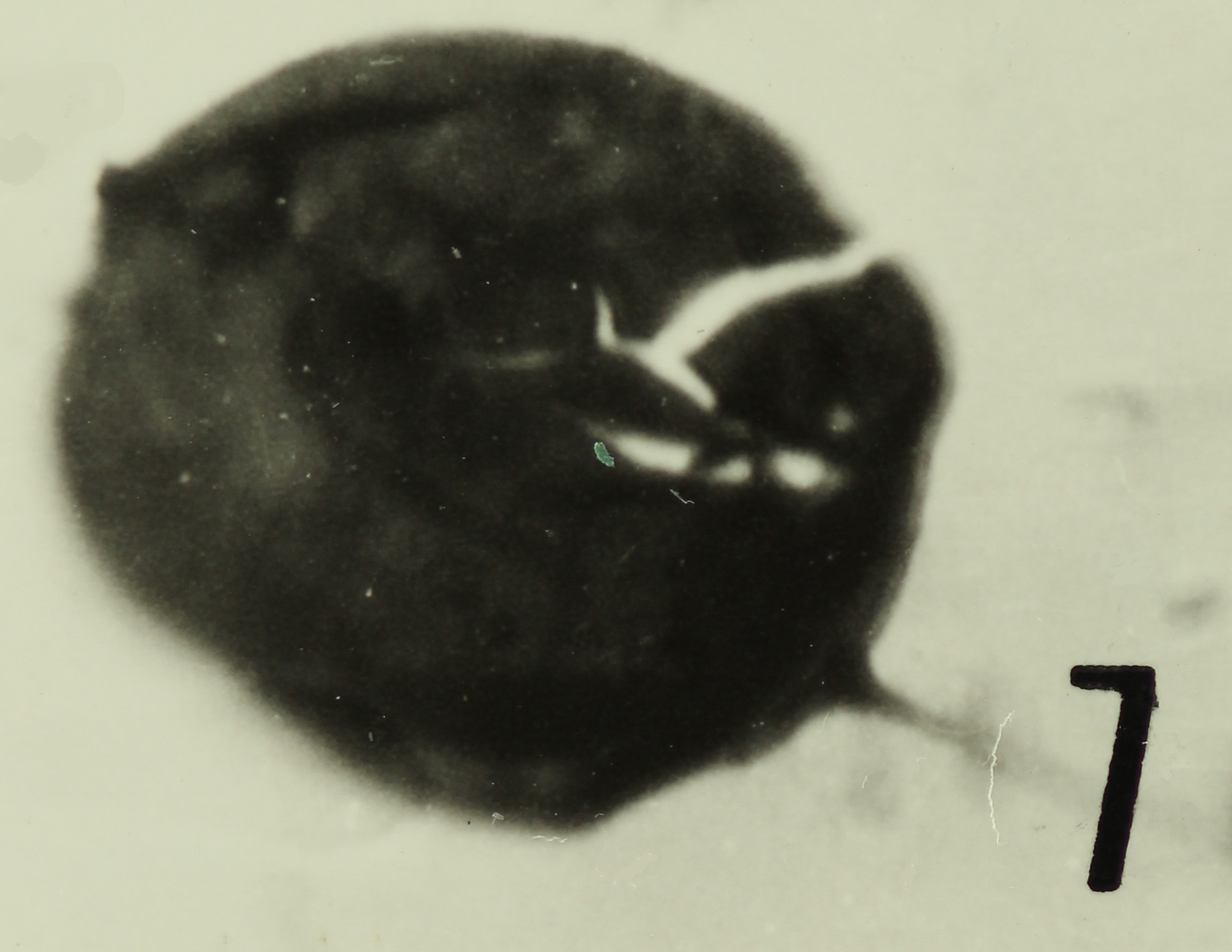 Fig. 7 - Acanthodiacrodium simplex Combaz, A., 1967. La Roquemaillère : ROQ-17. b 453.