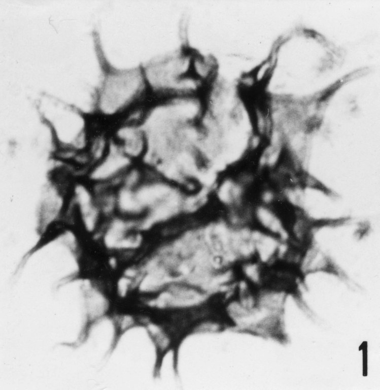 Fig. 1 - Acanthodiacrodium tuberatum (Downie, C., 1958) Martin, F., 1972. CHE-25. I. R. Se. N. B. N° b506.