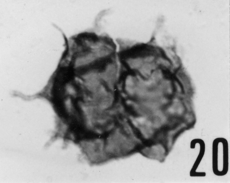 Fig. 20 - Acanthodiacrodium tuberatum (Downie, C., 1958) Martin, F., 1972. CHE-25. I. R. Se. N. B. N° b505. 