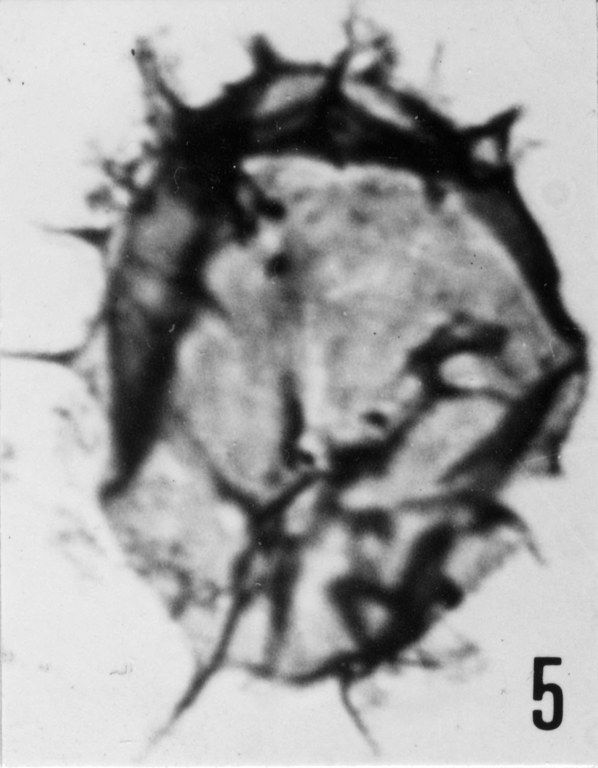 Fig. 5 - Acanthodiacrodium tuberatum (Downie, C., 1958) Martin, F., 1972. CHE-25. I. R. Se. N. B. N° b505. 