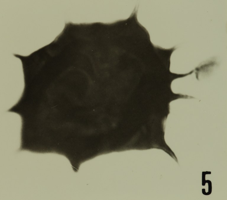 Fig. 5 - Acanthodiacrodium tuberatum (Downie, C., 1958) n. comb. Mas de Mougno : MOU-1. b 465.