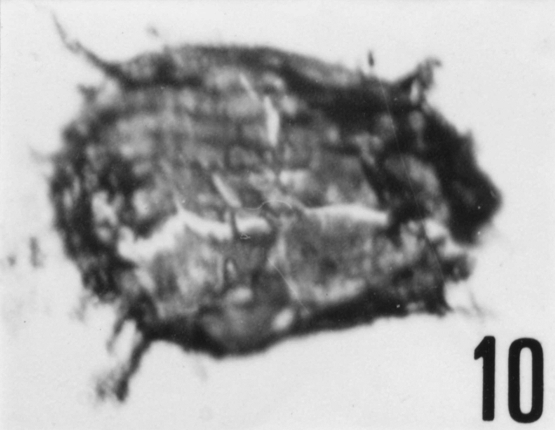 Fig. 10 - Acanthodiacrodium ubui Martin, F., 1969. CHE-25. I. R. Se. N. B. No b505.