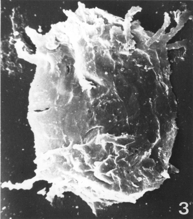 Fig. 3 - Acanthodiacrodium ubui Martin, F., 1969. CHE-31. I. R. Sc. N. B. No b532.