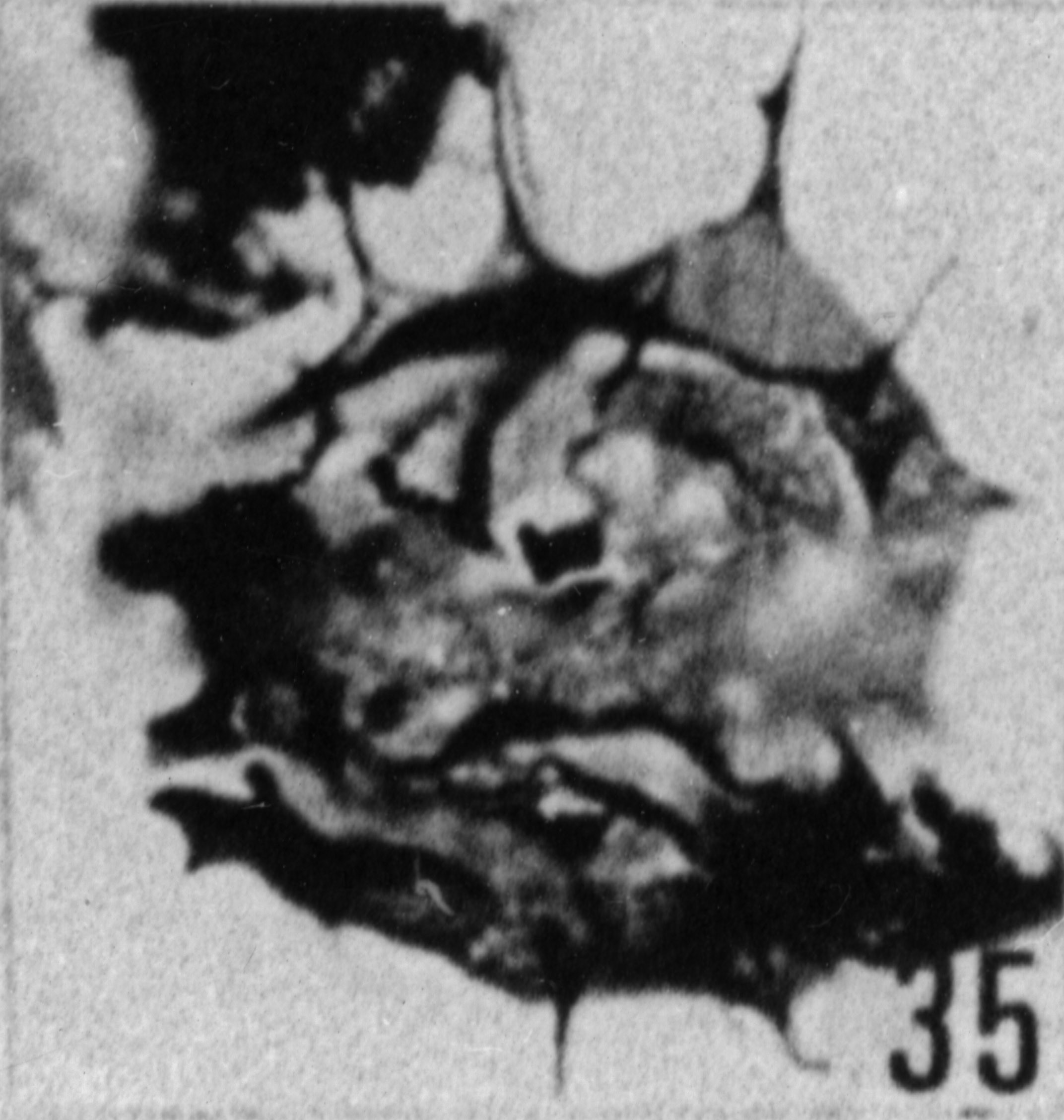 Fig. 35 - Baltisphaeridium coutissianum Martin. —169,00 m. b401.