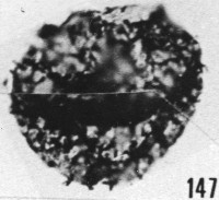 Fig. 147 - Baltisphaeridium ? massilum Martin; ouverture circulaire à contour proéminent. —174,00 m. b 375.