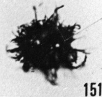 Fig. 151 - Baltisphaeridium cf. multipilosum (Eisenack). —154,50 m. b 365.