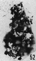 Fig. 52 - Chitinozoaire. Les orifices polygonaux criblant la paroi résultent de l'évacuation de cristaux de pyrite. — 172,50 m. b 410.
