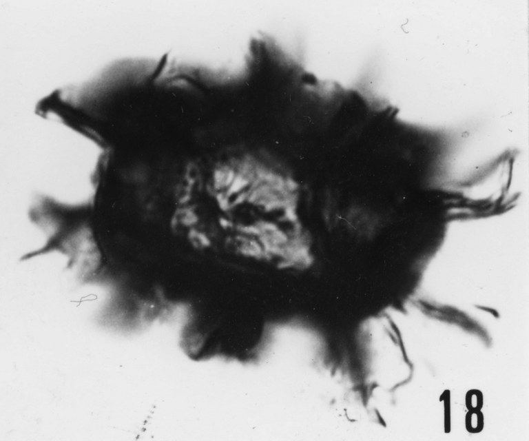 Fig. 18 - Cymatiosphaera crameri Slavikova, K., 1968. Mas de Mougno : MOU-1. b 461.