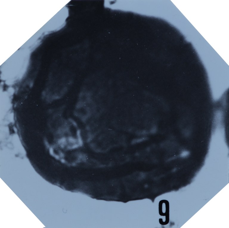 Fig. 9 - Dictyotidium bonneti n. sp. La Roquemaillère : ROQ-4. b 443