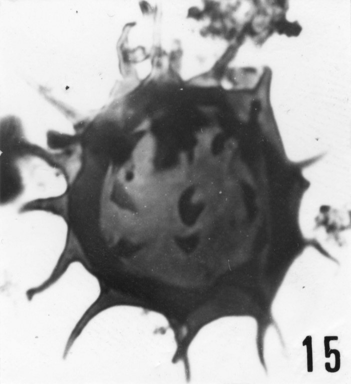 Fig. 15 - Goniosphaeridium uncinatum (Downie, C., 1958) Kjellström, G., 1971. La Roquemaillère : ROQ-4. b 443.