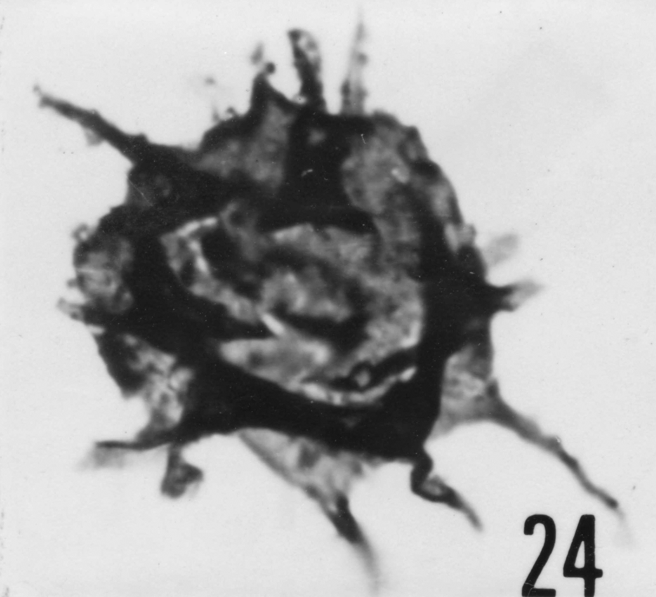 Fig. 24 - Goniosphaeridium uncinatum (Downie, C., 1958) Kjellström, G., 1971. CHE-16. I. R. Se. N. B. N° b489. 