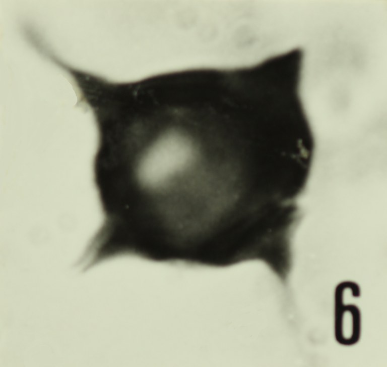 Fig. 6 - Impluviculus miloni (Deunff, J., 1968) Loeblich, A. R. et Tappan, H., 1969. Sainte-Cécile : STC-2. b 459. 