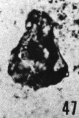 Fig. 47 - Lagenochitina reducta nov. sp. —172,50 m. b 406.
