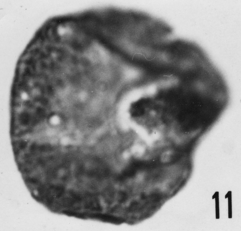 Fig. 11 - Leiosphaeridia aff. L. faveolata (Timofeev, B. V., 1959) Downie, C. et Sarjeant, w. A. S., 1963. THY-1. I. R. Se. N. B. N° b488.