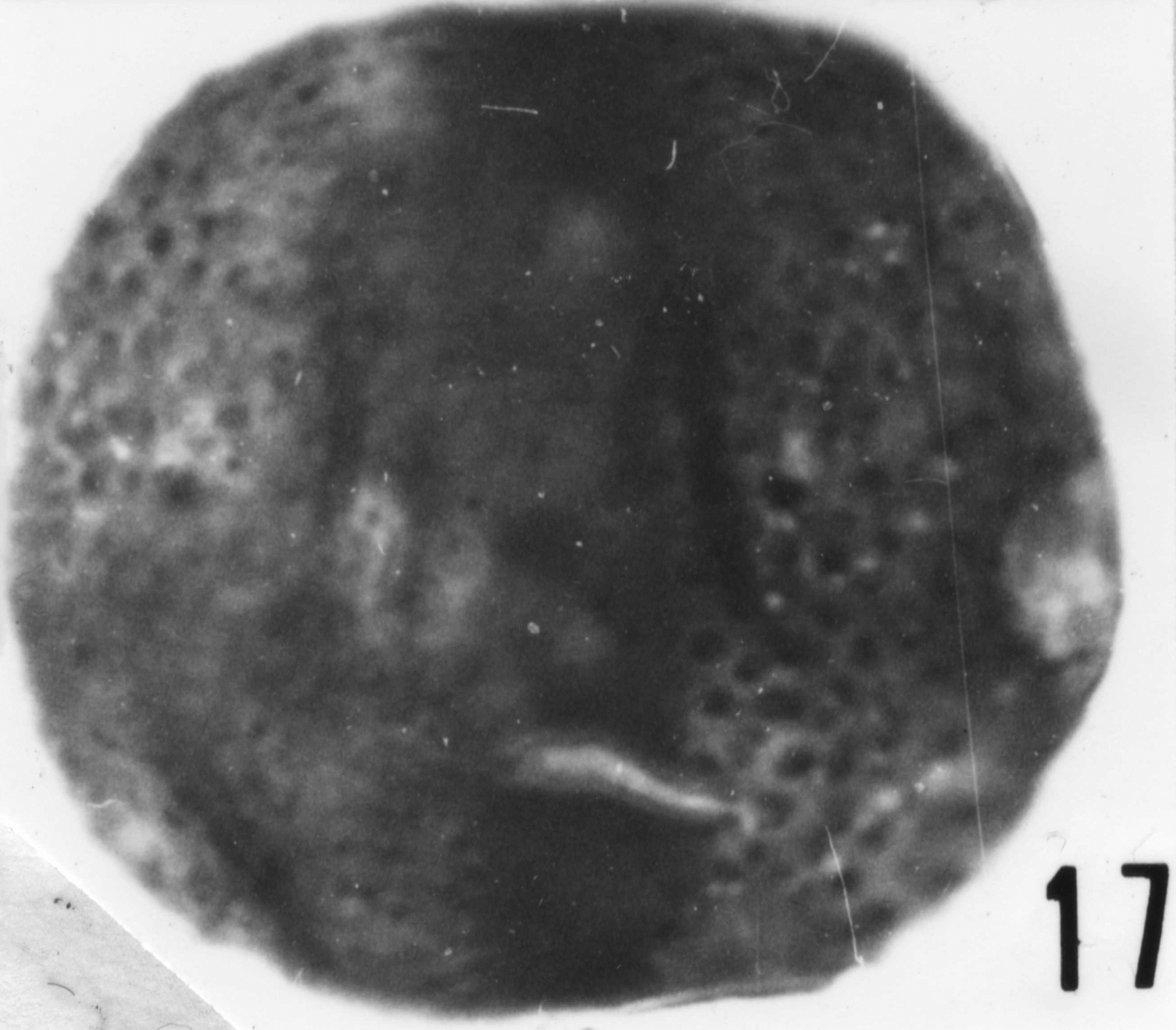 Fig. 17 - Lophodiacrodium echinatum (Naumova, S. N., 1950) Downie, C. et Sarjeant, W. A. S., 1964. La Roquemaillère : ROQ-6. b 448.