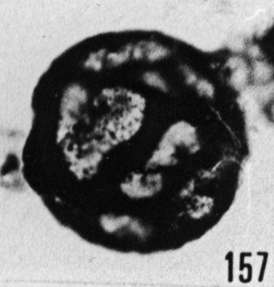 Fig. 157 - Lophosphaeridium papillatum (Staplin). —154,50 m. b361.