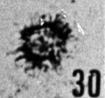 Fig. 30 - Micrhystridium campoae Stockmans et Willière. —172,50 m. b 410.