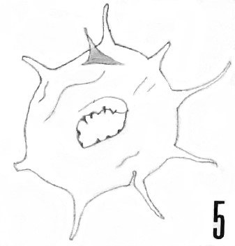 Fig. 5 - Micrhystridium cleae n. sp. Holotype. La Roquemaillère : ROQ-6. b 444.