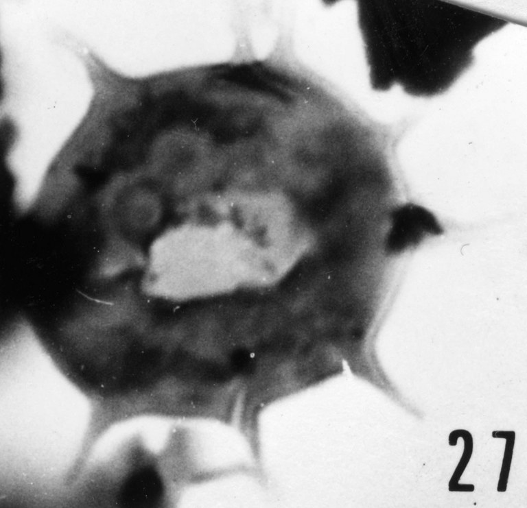 Fig. 27 - Micrhystridium cleae n. sp. Holotype. La Roquemaillère : ROQ-6. b 444.
