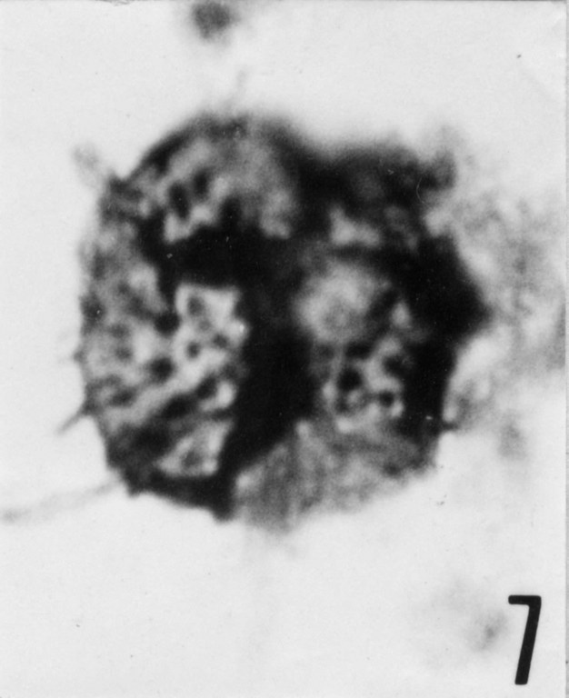 Fig. 7 - Micrhystridium pellitum n. sp. CHE-29. Holotype. I. R. Se. N. B. N° b509. 