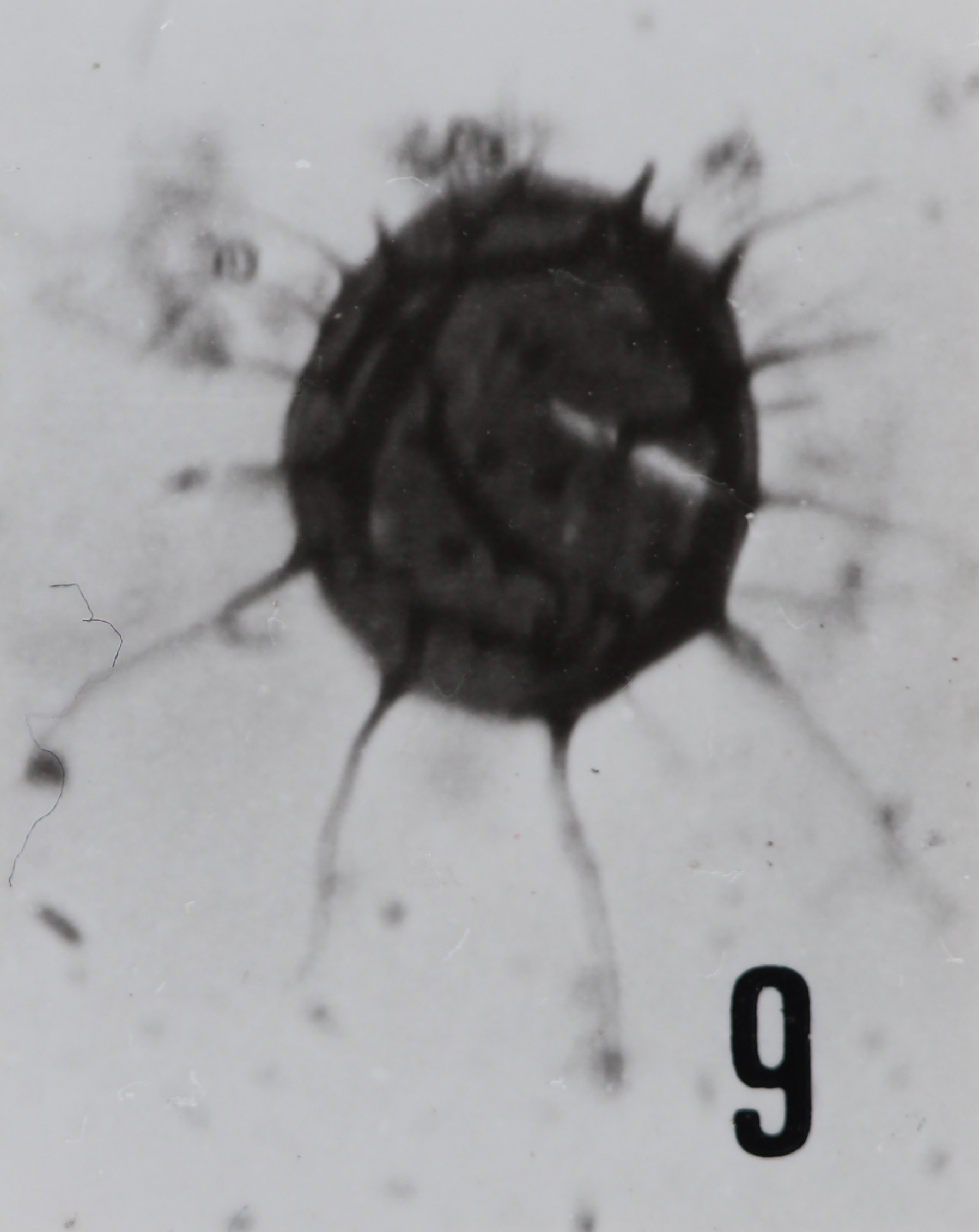 Fig. 9 - Micrhystridium shinetonensis Downie, C., 1958. Sainte-Cécile : STC-2. b 459. 
