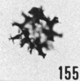 Fig. 155 - Multiplicisphaeridium lobeznum (Cramer); ouverture polygonale. -183,00 m. b 383.
