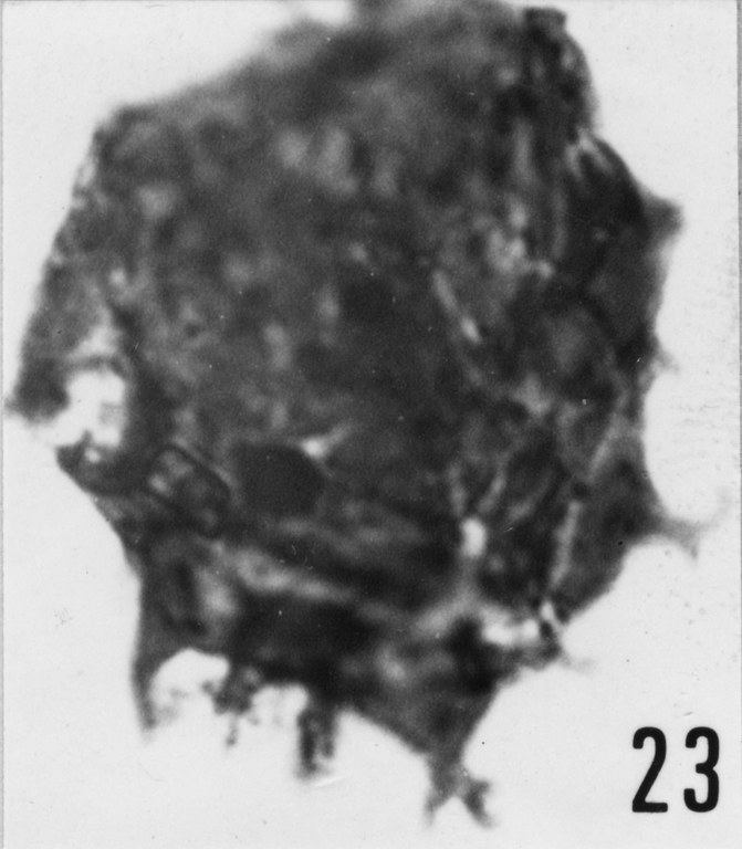 Fig. 23 - Multiplicisphaeridium ? martae Cramer, F. H. et Diez de Cramer, M. C. R., 1972. THY-1. I. R. Sc. N. B. N° b488.