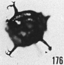 Fig. 176 - Multiplicisphaeridium aff. robertinum (Cramer). —154,50 m. b 358.