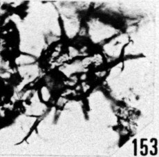 Fig. 153 - Multiplicisphaeridium rusticum nov. sp. —154,50 m. b 359.