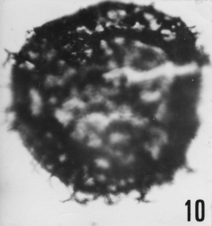 Fig. 10 - Peteinosphaeridium aff. P. breviradiatum (Eisenack, A., 1959) Eisenack, 1969. VIL-13. I. R. Se. N. B. No b527.