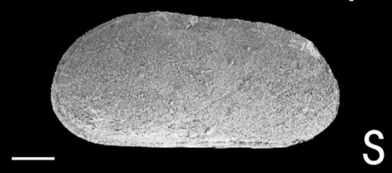 Fig. 3s - Cytherellina sp. B, aff. perlonga (Kummerow, 1953). RC. C Fm. ENO65. IRScNB n° b6782.